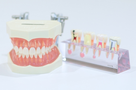 歯科技工士が常駐！スピーディーで質の高い技工が可能です。